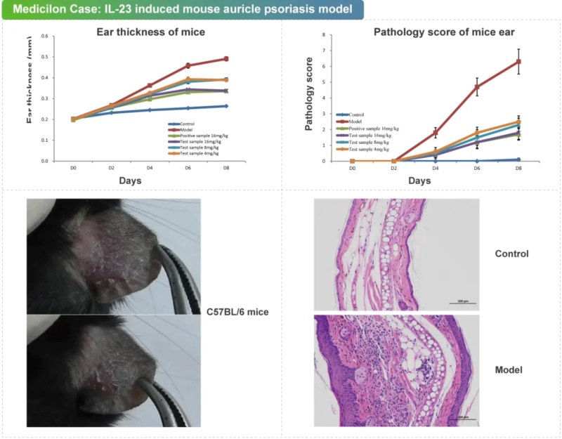 IL-23诱导的小鼠耳廓银屑病皮损样模型案例.webp